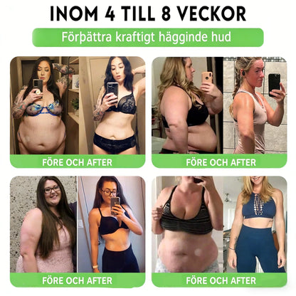 🥇𝐀𝐌𝐙𝐊𝐄𝐄𝐏® 𝐍𝐚𝐧𝐨-𝐦𝐢𝐤𝐫𝐨𝐧å𝐥𝐬𝐩𝐥å𝐬𝐭𝐞𝐫 𝐦𝐞𝐝 𝐍𝐀𝐃+, 𝐌𝐨𝐫𝐢𝐧𝐠𝐚 𝐨𝐜𝐡 𝐁𝐞𝐫𝐛𝐞𝐫𝐢𝐧 𝐟ö𝐫 𝐀𝐌𝐏𝐊-𝐬𝐭ö𝐝 𝟏 𝐠å𝐧𝐠 𝐝𝐚𝐠𝐥𝐢𝐠𝐞𝐧, 𝐬𝐲𝐧𝐥𝐢𝐠𝐚 𝐟ö𝐫ä𝐧𝐝𝐫𝐢𝐧𝐠𝐚𝐫 𝐩å 𝟕 𝐝𝐚𝐠𝐚𝐫. 𝐒𝐭ö𝐝𝐣𝐞𝐫 𝐦𝐞𝐭𝐚𝐛𝐨𝐥𝐢𝐬𝐦, 𝐯𝐢𝐤𝐭𝐤𝐨𝐧𝐭𝐫𝐨𝐥𝐥, 𝐡𝐣ä𝐫𝐭𝐡ä𝐥𝐬𝐚, 𝐟𝐞𝐭𝐦𝐚, 𝐥ö𝐬 𝐡𝐮𝐝, 𝐝𝐢𝐚𝐛𝐞𝐭𝐞𝐬, 𝐬ö𝐦𝐧𝐚𝐩𝐧é, 𝐥𝐞𝐝𝐛𝐞𝐬𝐯ä𝐫 𝐦.𝐦.